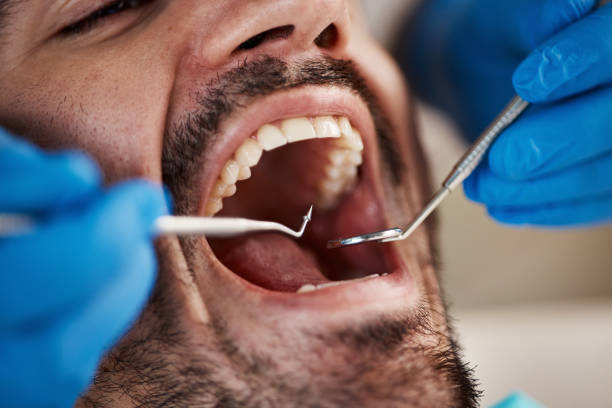 Best Cosmetic Dentistry  in Federal Y, WA